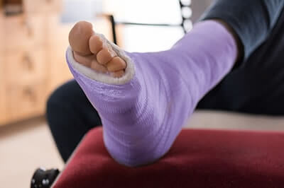 Foot and ankle fractures treatment in the Palm Beach County, FL: West Palm Beach (Royal Palm Beach, Loxahatchee, Riviera Beach, Boca Del Mar, Belle Glade) areas
